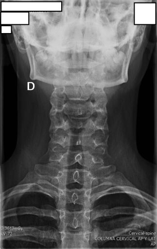 AP Cervical Radiograph
